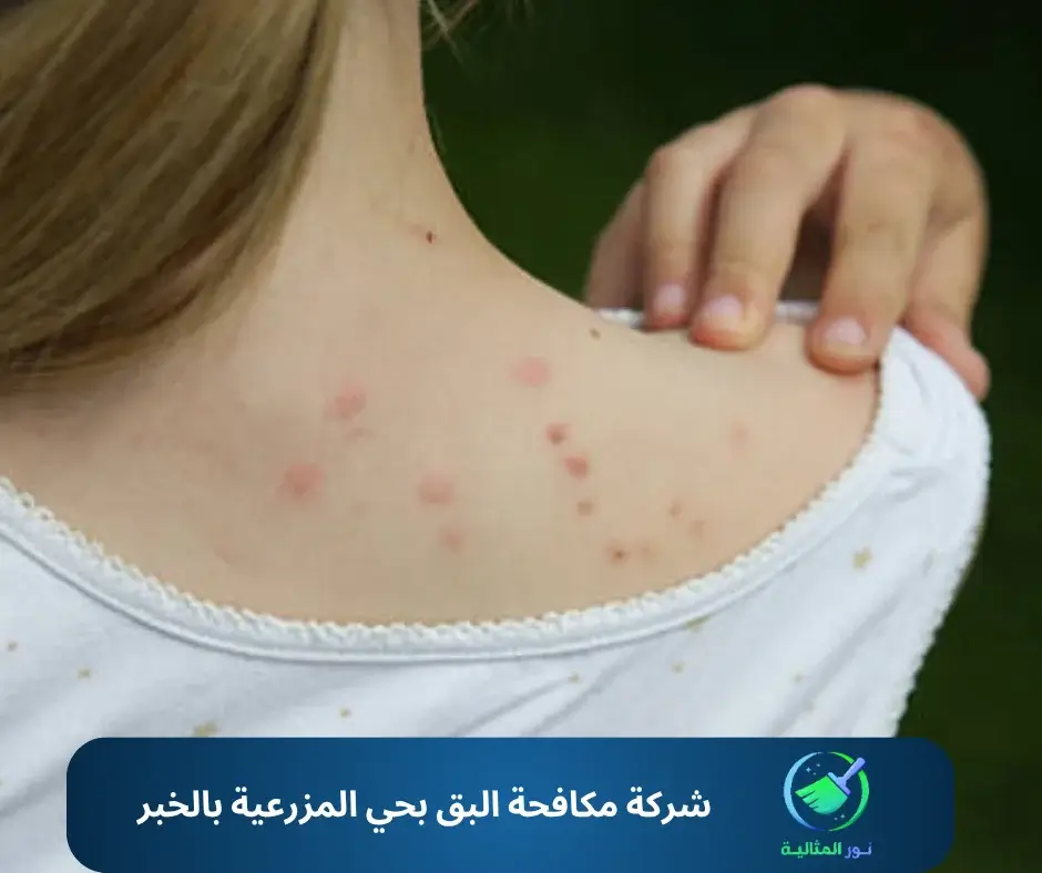 شركة مكافحة البق بحي المزرعية بالخبر